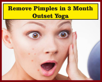 Pimples Complete remove by yoga in deoria